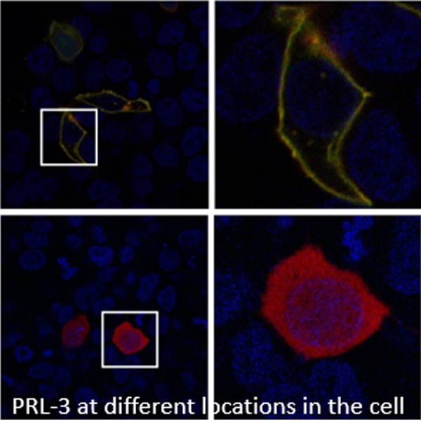 Funding from the NCI! Unraveling the Role of PRL-3 in Cancer
